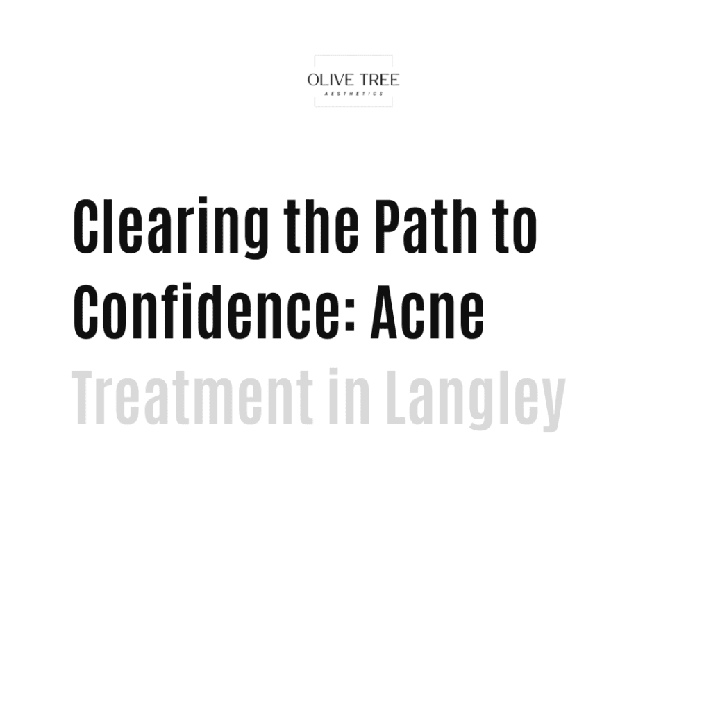 Clearing the Path to Confidence: Acne Treatment in Langley